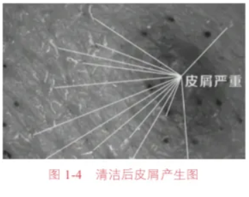 清潔后皮屑產生圖